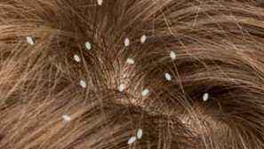 Jak kousavé ložní prádlo, fotky kousnutí